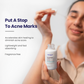 Pitstop Blue Niacinamide Serum